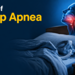 Signs of Sleep Apnea with an illustration of airway obstruction during sleep.