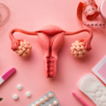Symptoms of PCOS ,Causes with a medical illustration of the uterus and ovaries